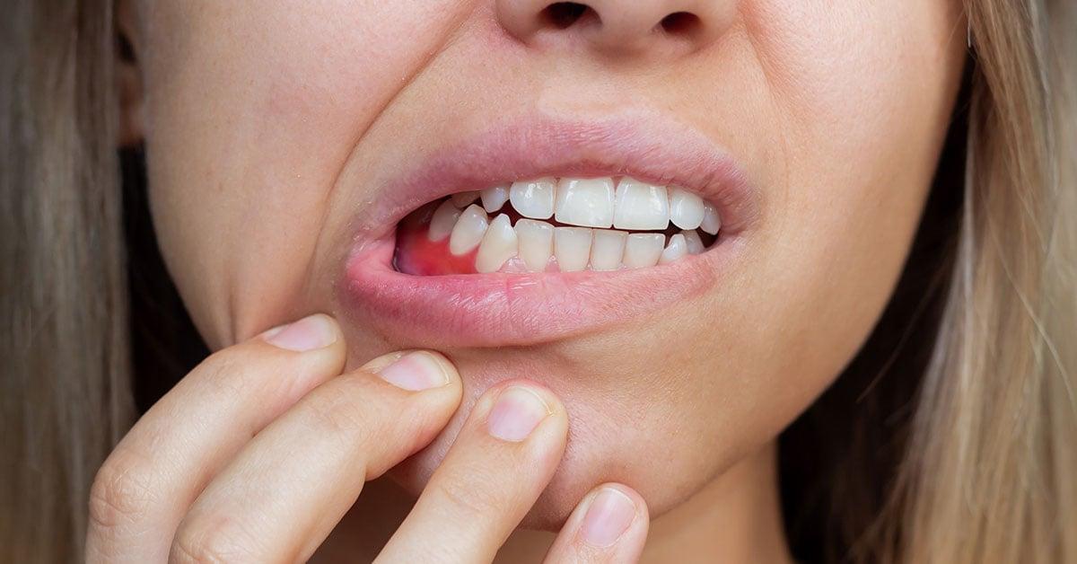 Why Gum Disease Shouldn't Be Ignored (and What to Do Instead)