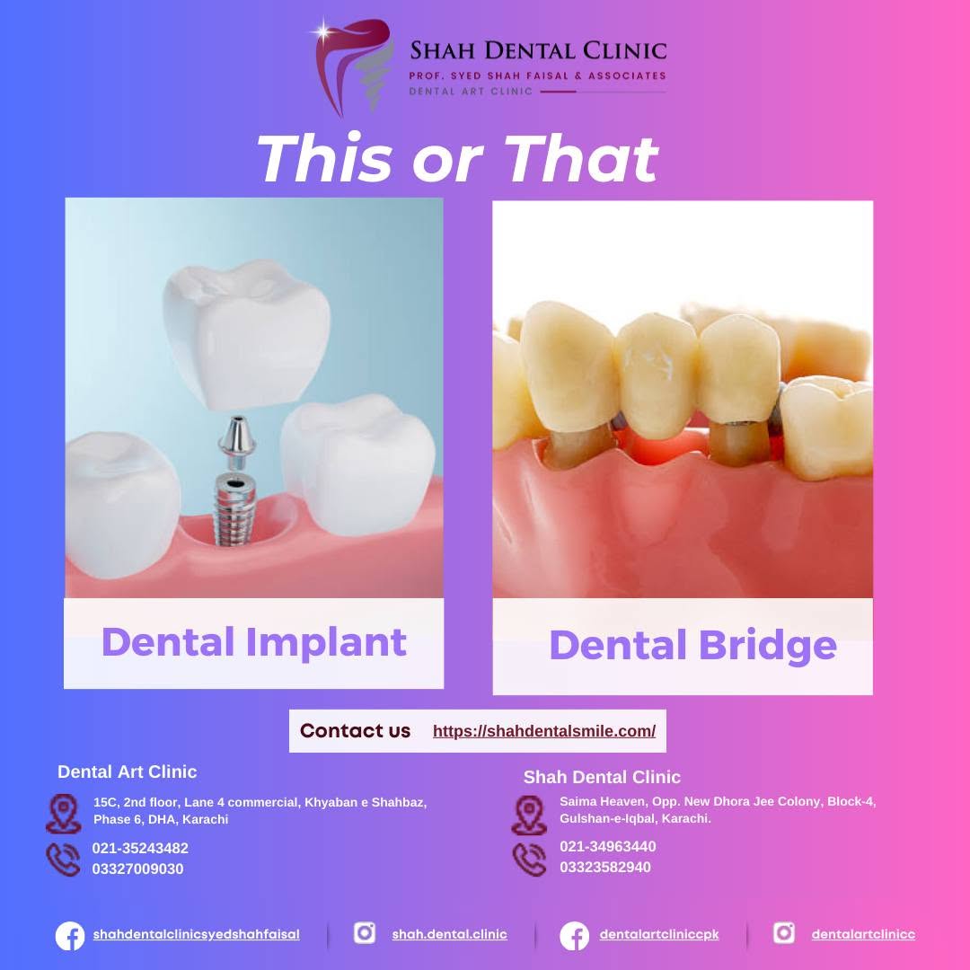 Dental Implant & Dental Bridge